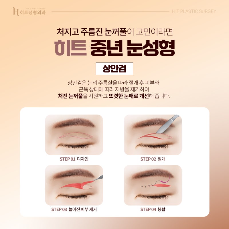 [히트성형외과] 중년 눈성형이 중요한 이유 사진 2