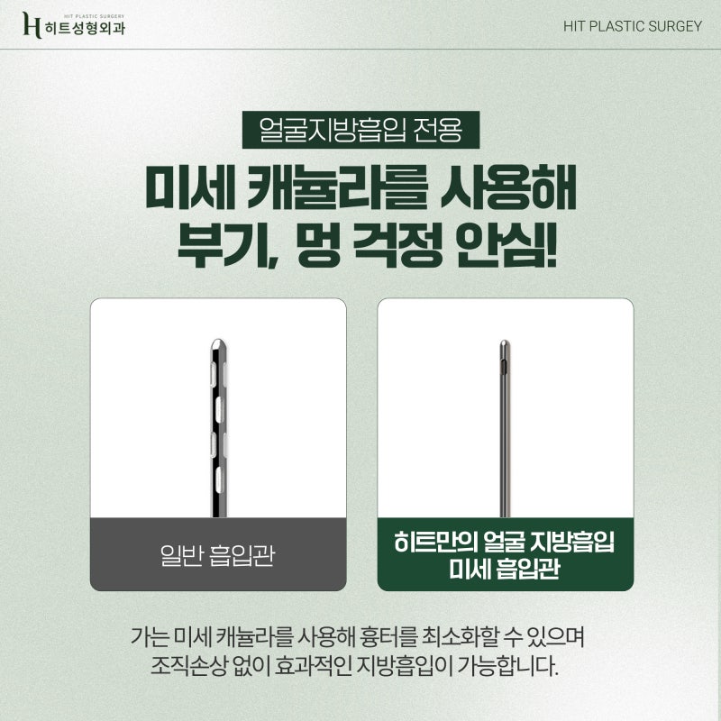 [히트성형외과] 안면윤곽 후 살 처짐 개선방법, 히트 얼굴지방흡입 사진 4