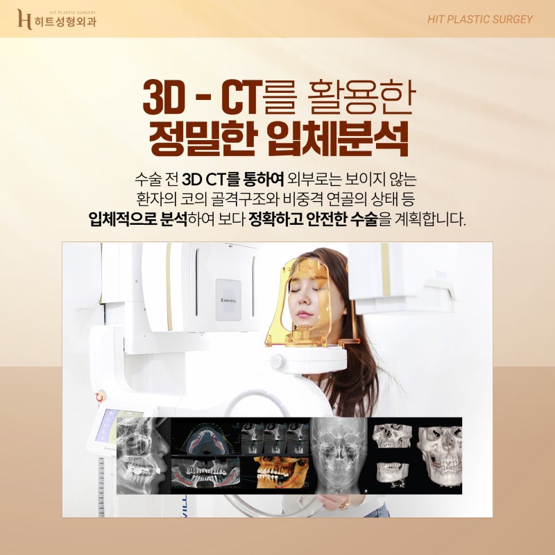 [히트성형외과] 중안부가 길어보인다면? 히트 긴코 성형 사진 5