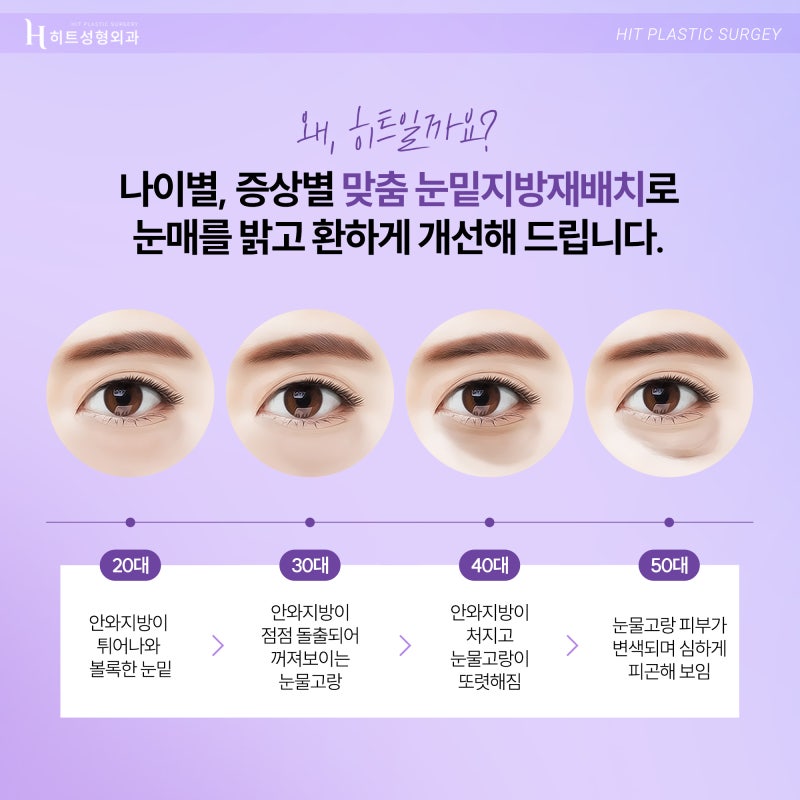 [히트성형외과] 어둡고 칙칙한 눈매 개선법, 히트 눈밑지방재배치 사진 3