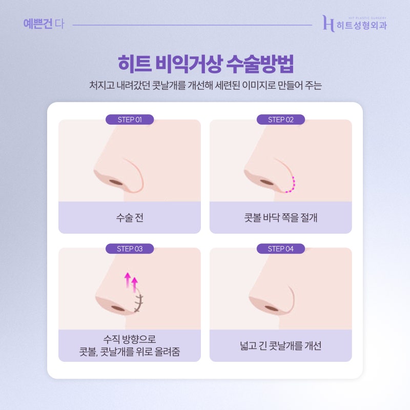 [히트성형외과] 이상적인 콧볼과 코끝을 위한 히트 비익거상 사진 4