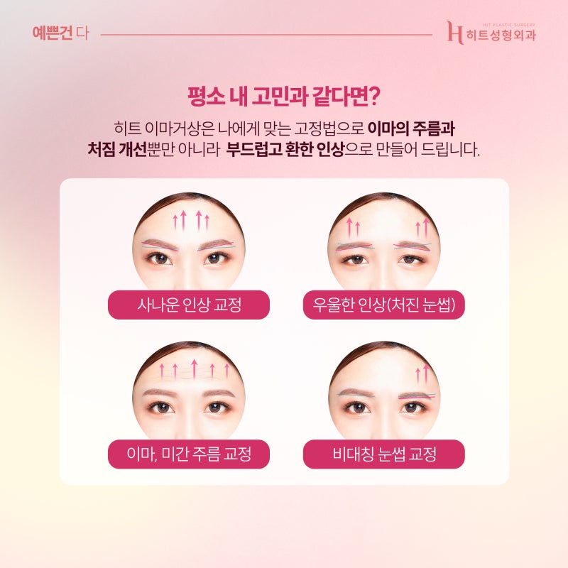 [히트성형외과] 이마거상 어떤 고정법이 나에게 맞을까? 사진 4