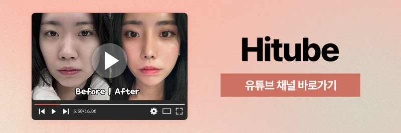 [히트성형외과] 얼굴지방흡입 후 주의해야할 점 사진 8