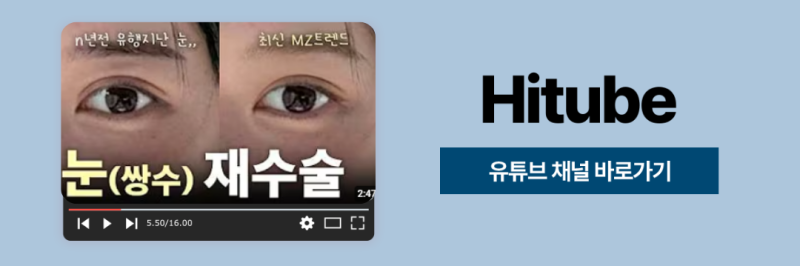 [히트성형외과] 남자를 위한 자연스러운 맞춤 눈성형 사진 8