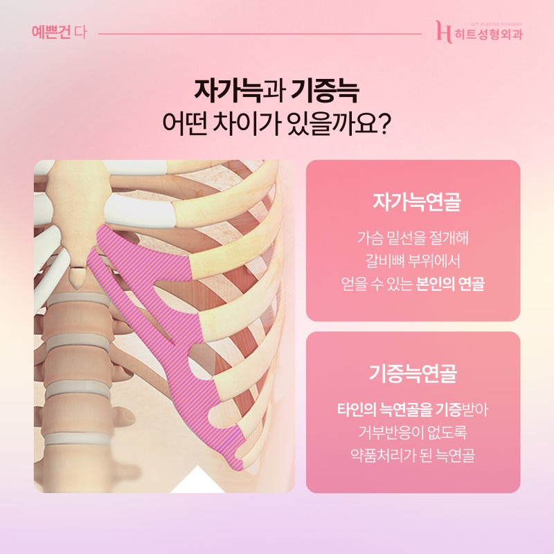 [히트성형외과] 코수술시 사용되는 자가늑 기증늑, 어떤 재료가 좋을까?