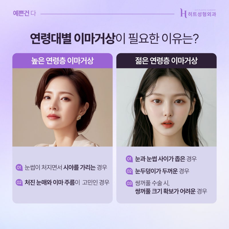 [히트성형외과] 이마거상, 나이 든 사람만 하는 걸까?
