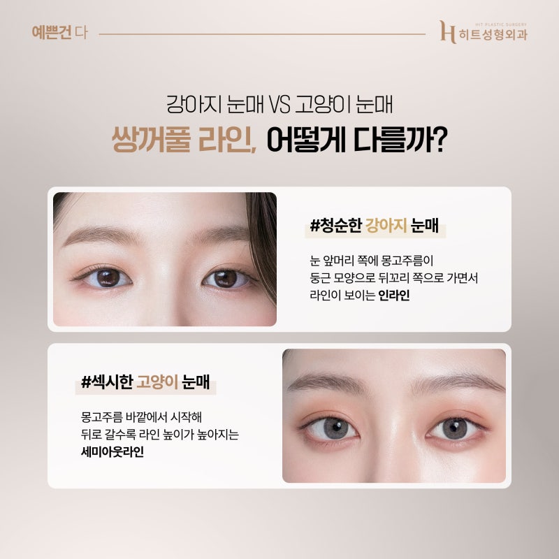 [히트성형외과] 강아지 눈매 VS 고양이 눈매 원하는 느낌에 따라! 사진 2