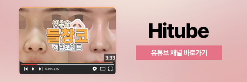 [히트성형외과] 정면에서 봤을 때 콧구멍이 보인다면, 들창코일까? 사진 8