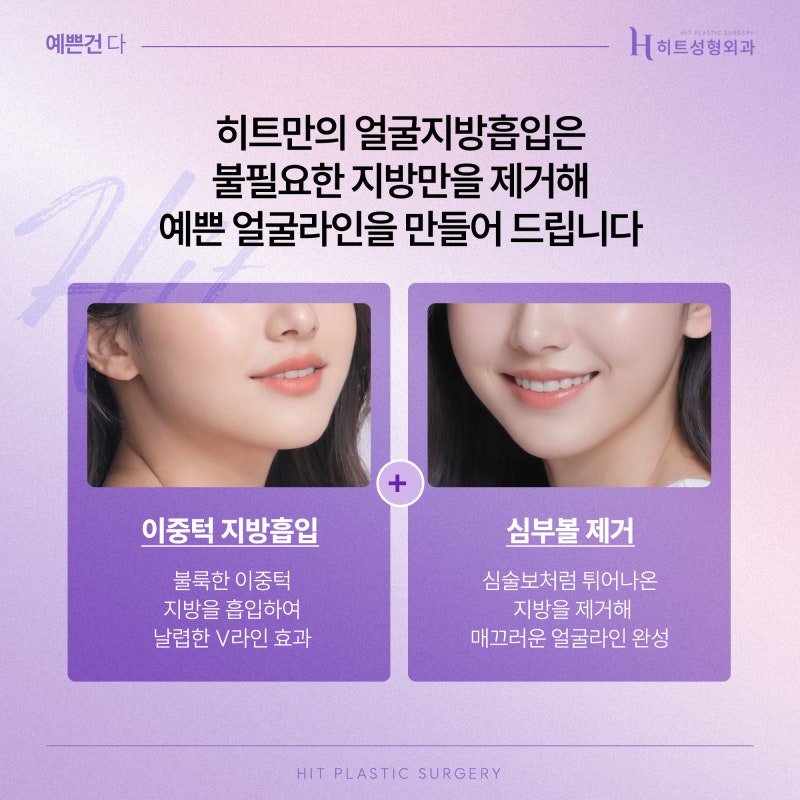 [히트성형외과] 볼살에도 예쁜볼살, 미운볼살이 있다?! 사진 5