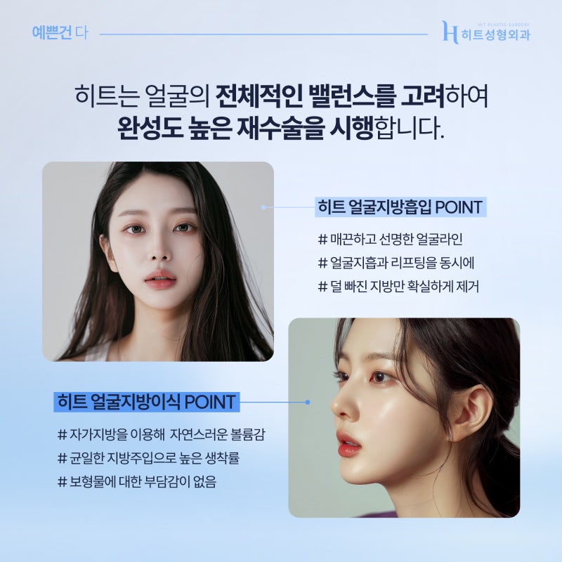 [히트성형외과] 이중턱지방흡입 재수술 케이스는? 사진 5