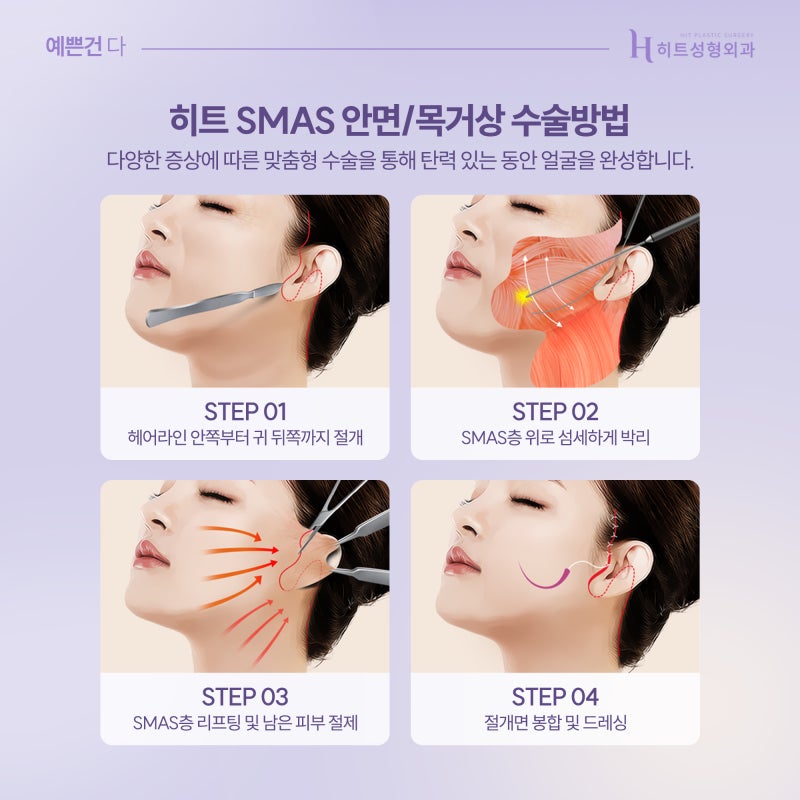 [히트성형외과] 히트 SMAS 안면/목거상 ! 사진 4
