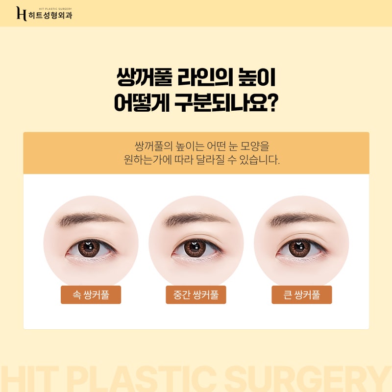 [히트성형외과] 나에게 맞는 쌍꺼풀 라인의 높이는?