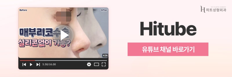 [히트성형외과] 무보형물 코 누구나 가능할까? 사진 7