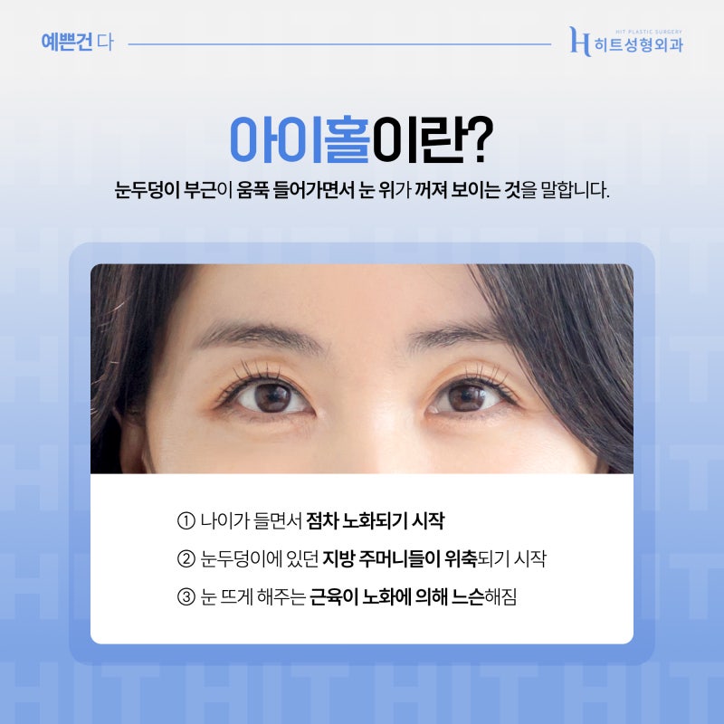 [히트성형외과] 아이홀이 생기는 원인은?