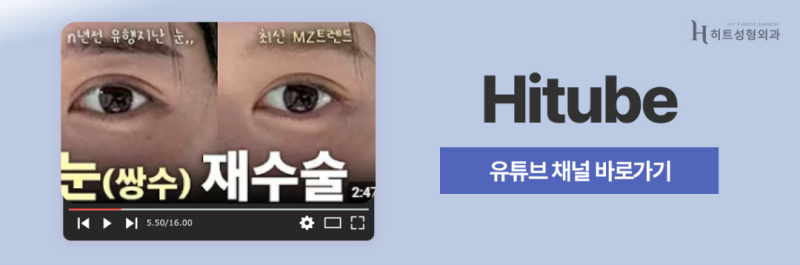 [히트성형외과] 짝눈, 어떤 식으로 수술해야 할까? 사진 8