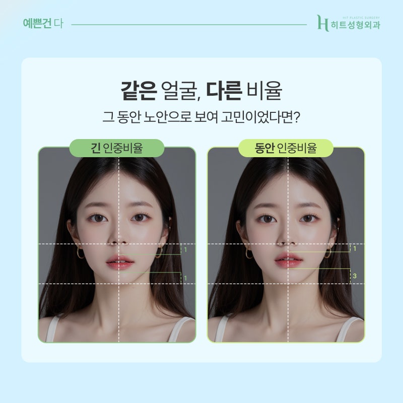 [히트성형외과] 중안면부가 긴 얼굴, 코 수술 방법은?