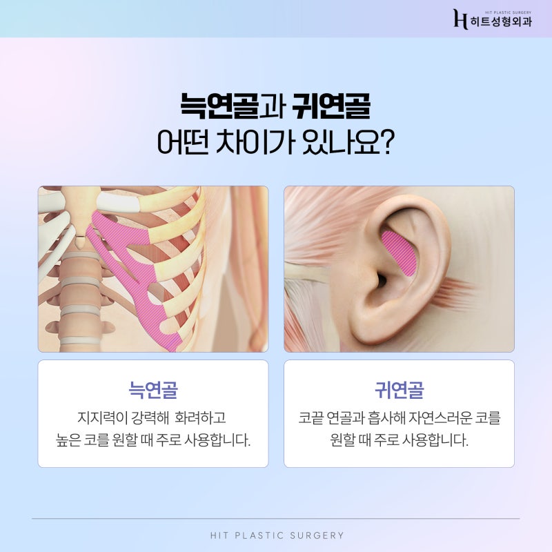 [히트성형외과] 코 수술, 늑연골로 한다면? 사진 3