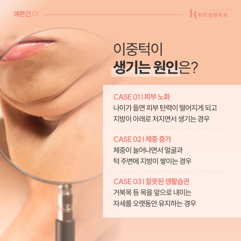 [히트성형외과] 이중턱이 생기는 이유와 습관!