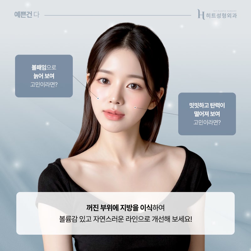 [히트성형외과] 동안 얼굴을 원한다면? 얼굴살의 중요성!