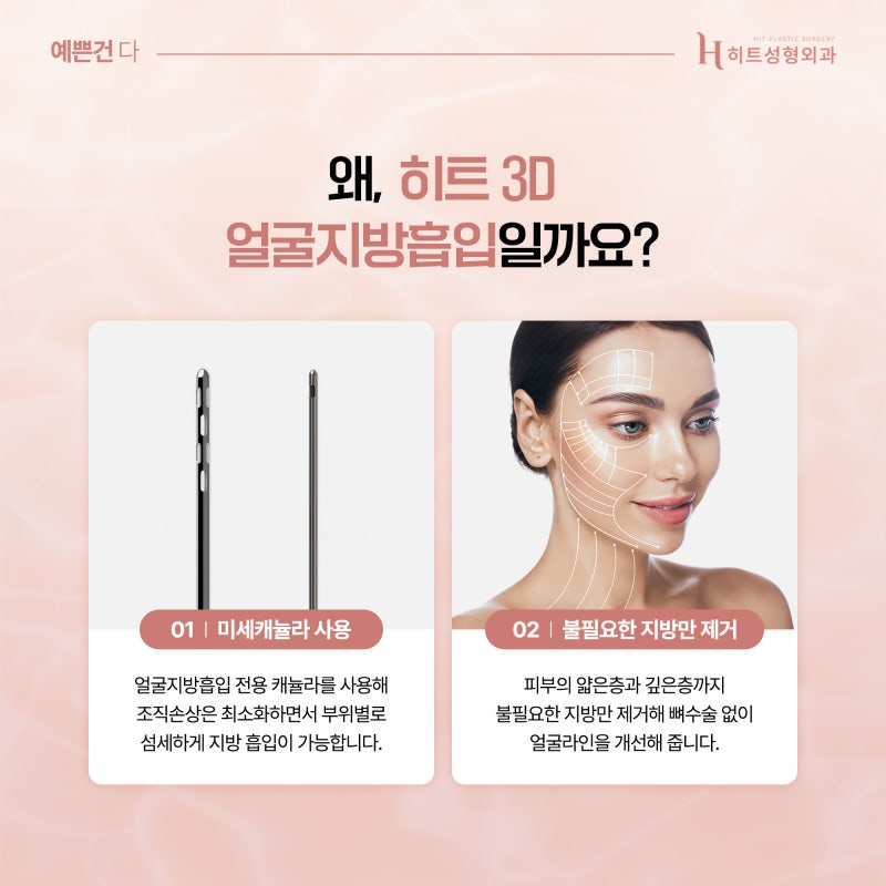 [히트성형외과] 얼굴지방흡입으로 얼굴형 개선이 가능하다고? 사진 4