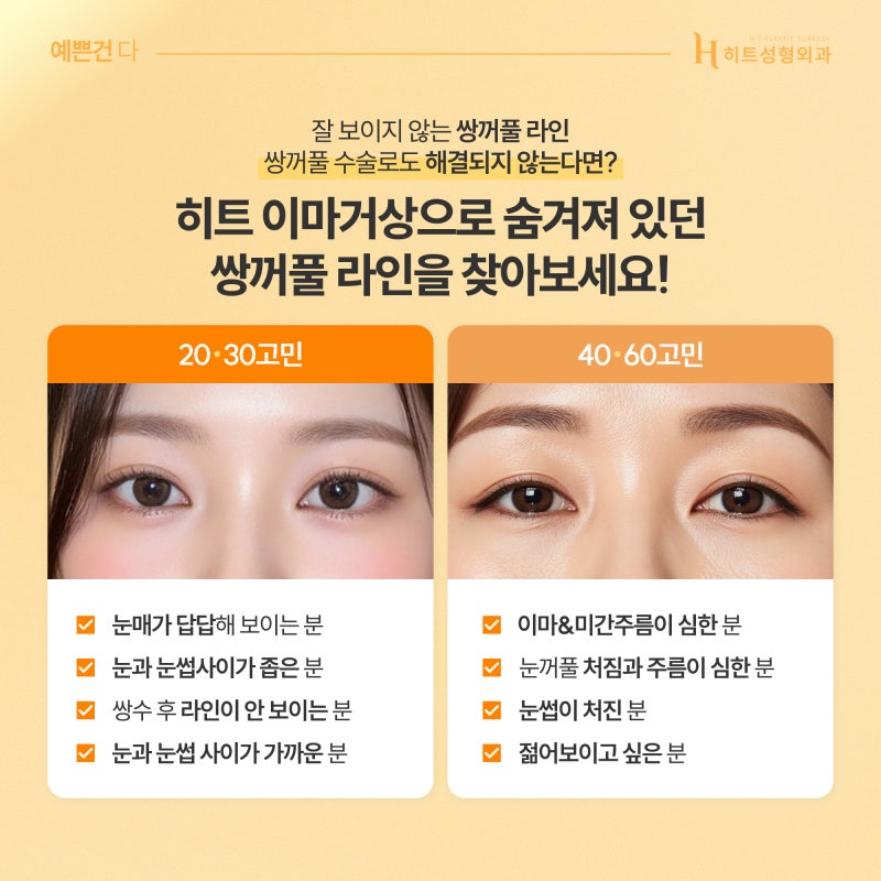 [히트성형외과] 쌍꺼풀 수술 or 이마거상! 나에게 맞는 수술 방법은? 사진 4