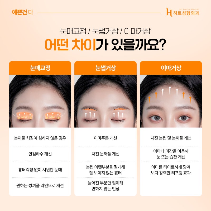 [히트성형외과] 눈매교정 눈썹거상 이마거상 각 수술의 차이점은?
