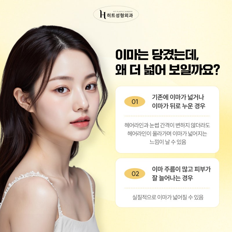[히트성형외과] 이마거상 후 넓은 이마 해결 방법은? 사진 3