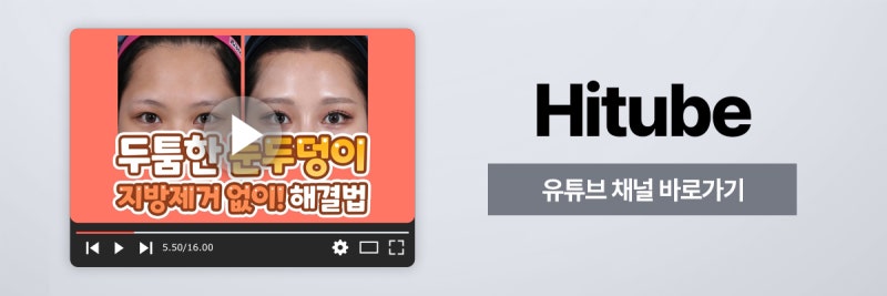 [히트성형외과] 두툼한 눈두덩이, 지방제거만이 해결 방법일까요? 사진 8