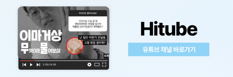 [히트성형외과] 눈꺼풀 처짐, 이마거상으로 개선하는 이유는? 사진 8