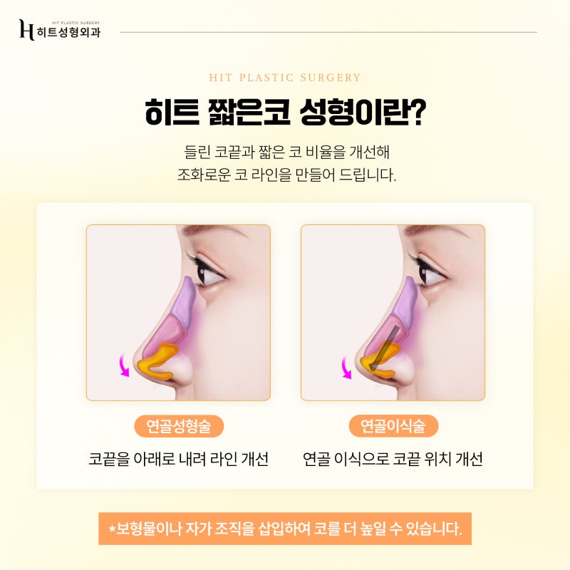 [히트성형외과] 내 얼굴에 맞는 코 유형, 어떻게 구분할까요? 사진 5
