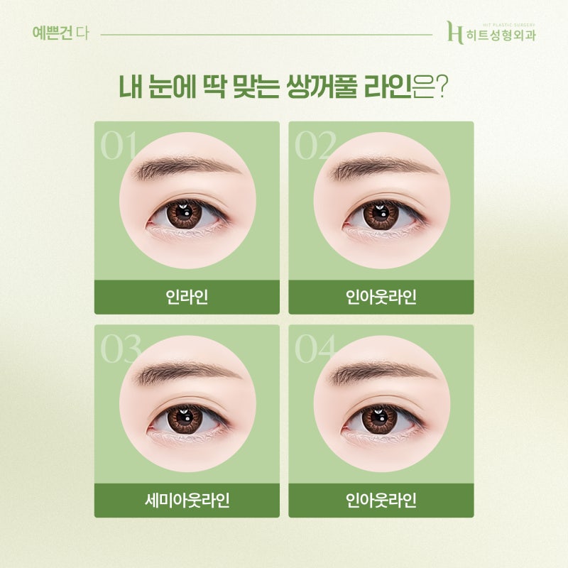 [히트성형외과] 쌍꺼풀 라인 높이에 따라 인상이 달라진다! 사진 3