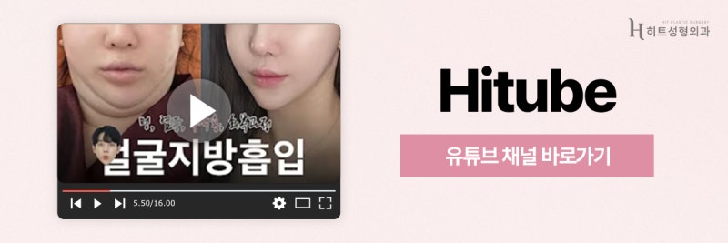 [히트성형외과] 얼굴지방흡입 원하는 부위만 가능할까? 사진 8