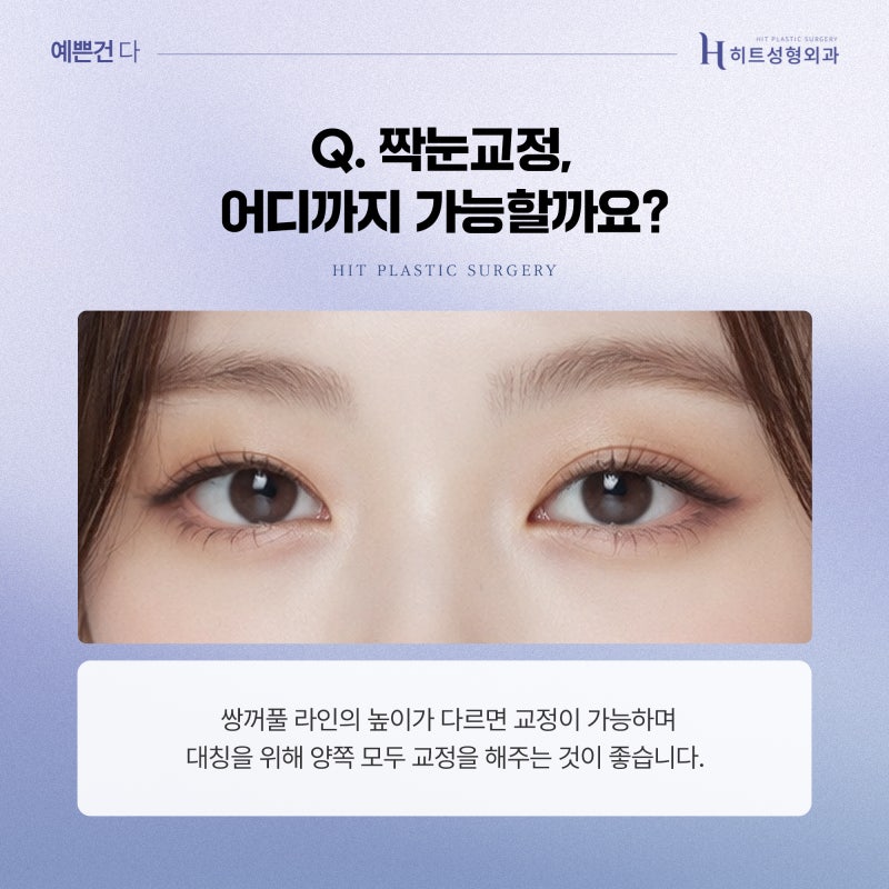 [히트성형외과] 짝눈 교정, 어떤 수술이 정답일까요? 사진 4