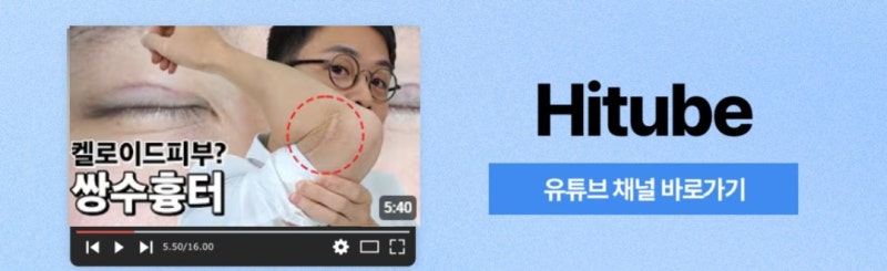 [히트성형외과] 눈 성형 전/후 꼭 알아야 할 체크리스트! 사진 8