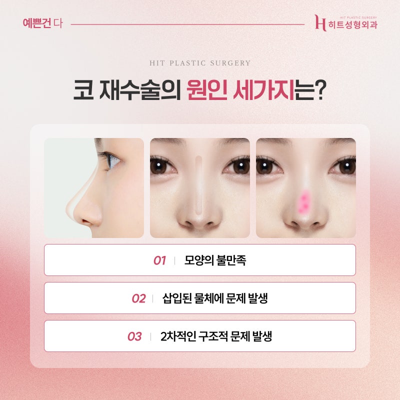 [히트성형외과] 첫 코수술 후 후회하는 이유 TOP3!