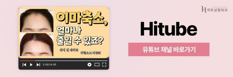[히트성형외과] 넓은 이마 축소! 회복기간 동안 피해야 할 생활 습관은? 사진 8