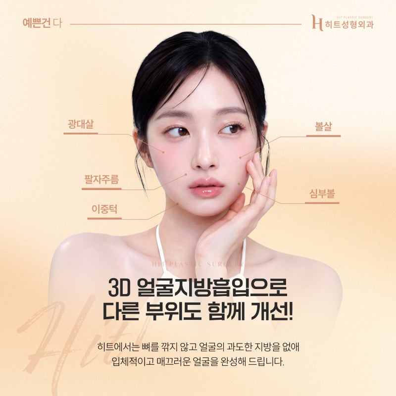 [히트성형외과] 얼굴지방흡입, 이중턱만 제거해도 달라질까요? 사진 5