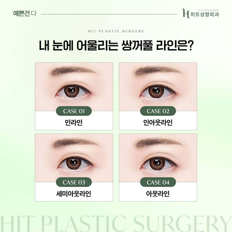 [히트성형외과] 눈 성형 후 쌍커풀 라인이 풀리는 이유는? 사진 3