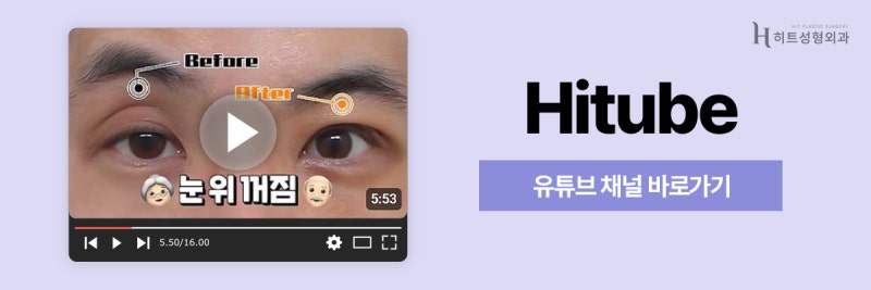 [히트성형외과] 짝눈 교정, 눈매교정으로 개선 가능할까? 사진 8