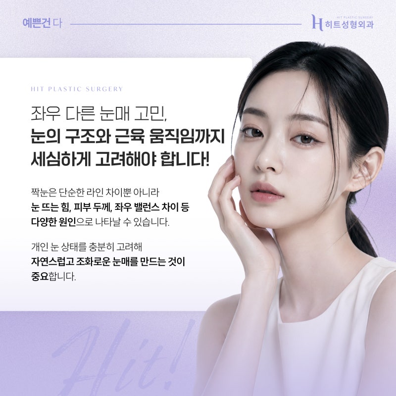 [히트성형외과] 짝눈 교정, 눈매교정으로 개선 가능할까?