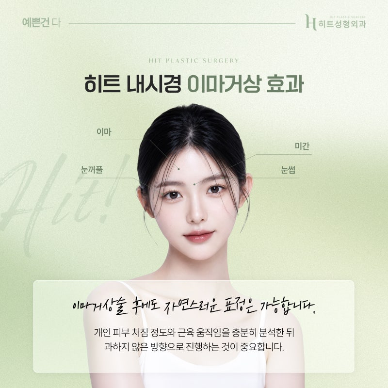 [히트성형외과] 이마거상술 후 표정이 어색해질까요? 사진 4