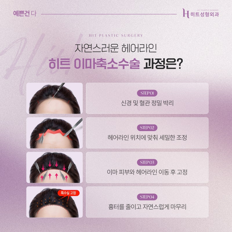 [히트성형외과] 이마축소술 후 헤어라인 디자인이 중요한 이유 사진 5