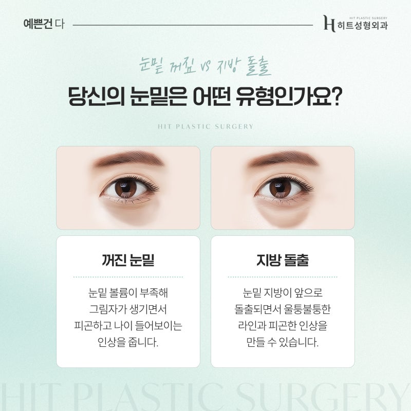 [히트성형외과] 눈 밑 꺼짐 vs 지방 돌출, 어떤 수술이 필요할까?