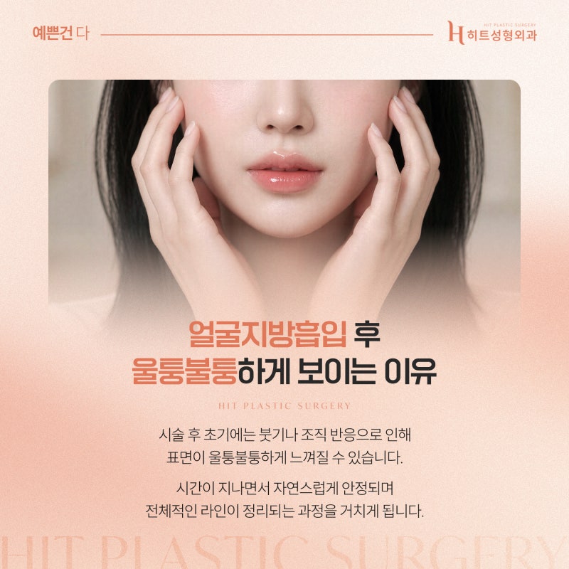 [히트성형외과] 얼굴지방흡입 후 라인이 울퉁불퉁해지는 이유