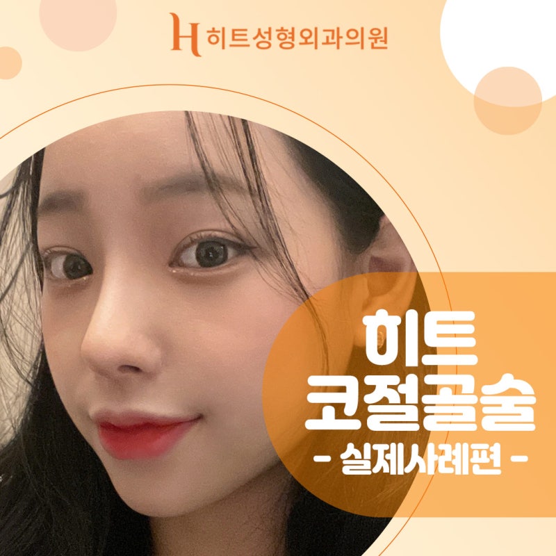 코절골술 휜코에 도움됩니다