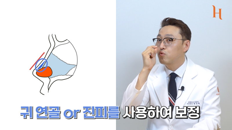 무보형물 코성형 방법이 궁금하다면 [히트성형외과] 사진 5