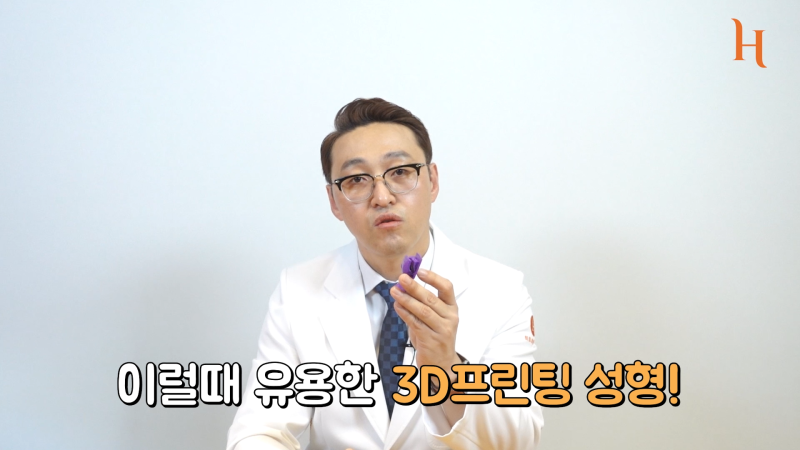 3D프린팅코성형으로 내 코에 딱 맞게 하자! 사진 5