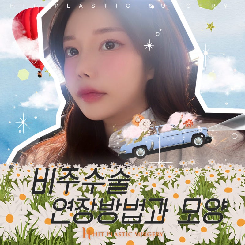 비주수술 연장방법과 모양 : 실제사례 [히트성형외과]