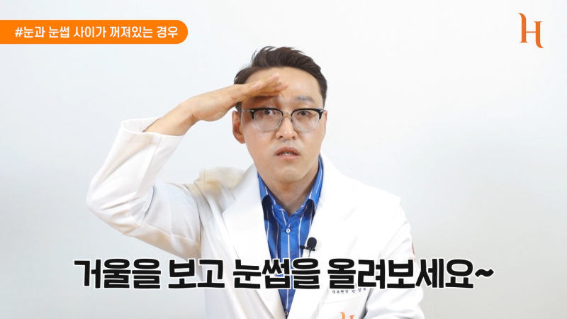 내시경이마거상 하면 안되는 이유 사진 8
