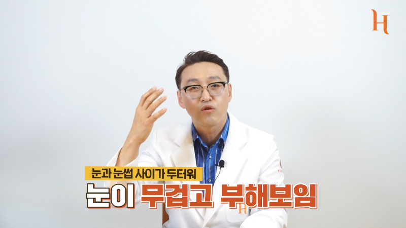 내시경이마거상 하면 안되는 이유 사진 3